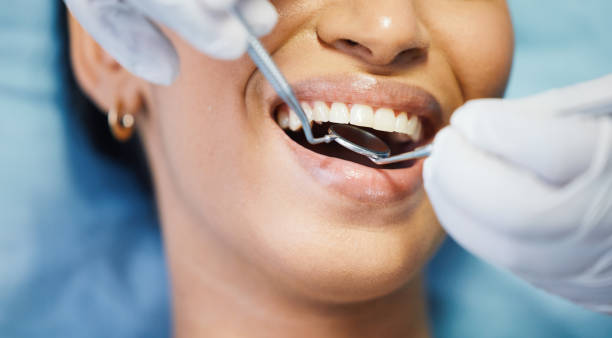 Best Orthodontic Emergency Dentist in Fruitdale, CA