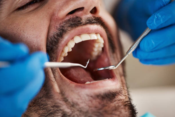 Best Orthodontic Emergency Dentist in Fruitdale, CA