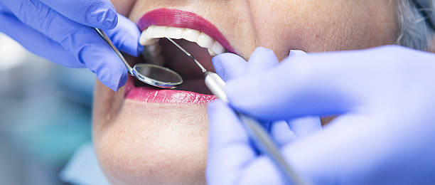Best Urgent Dental Care for Toothache in Fruitdale, CA