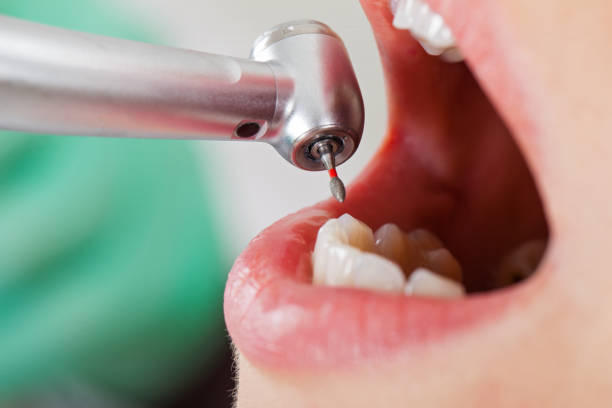 Best Emergency Dentist for Special Needs Patients in Fruitdale, CA
